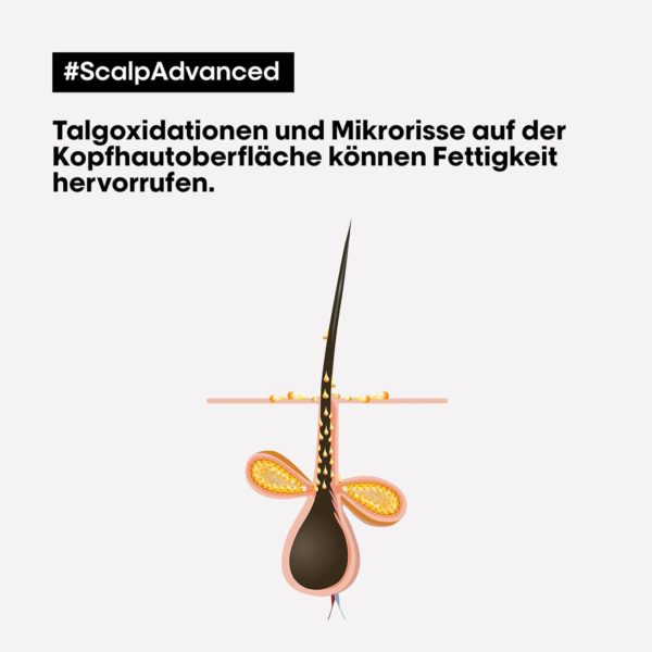 L’Oréal Professionnel Serie Expert Scalp Advanced Anti‑Fettend Dermo Purifier Shampoo – Bild 5