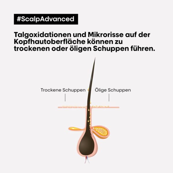 L’Oréal Professionnel Serie Expert Scalp Advanced Anti‑Schuppen Dermo Clarifier Shampoo – Bild 6