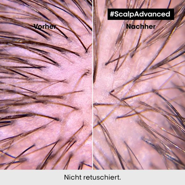 L’Oréal Professionnel Serie Expert Scalp Advanced Anti‑Schuppen Dermo Clarifier Shampoo – Bild 7